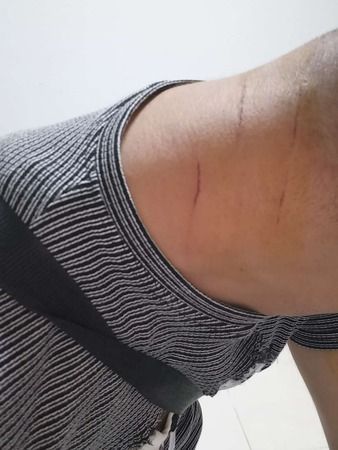 Mülteci sorunu son bulmuyor: İlçe başkanını darp edip serbest kaldılar!