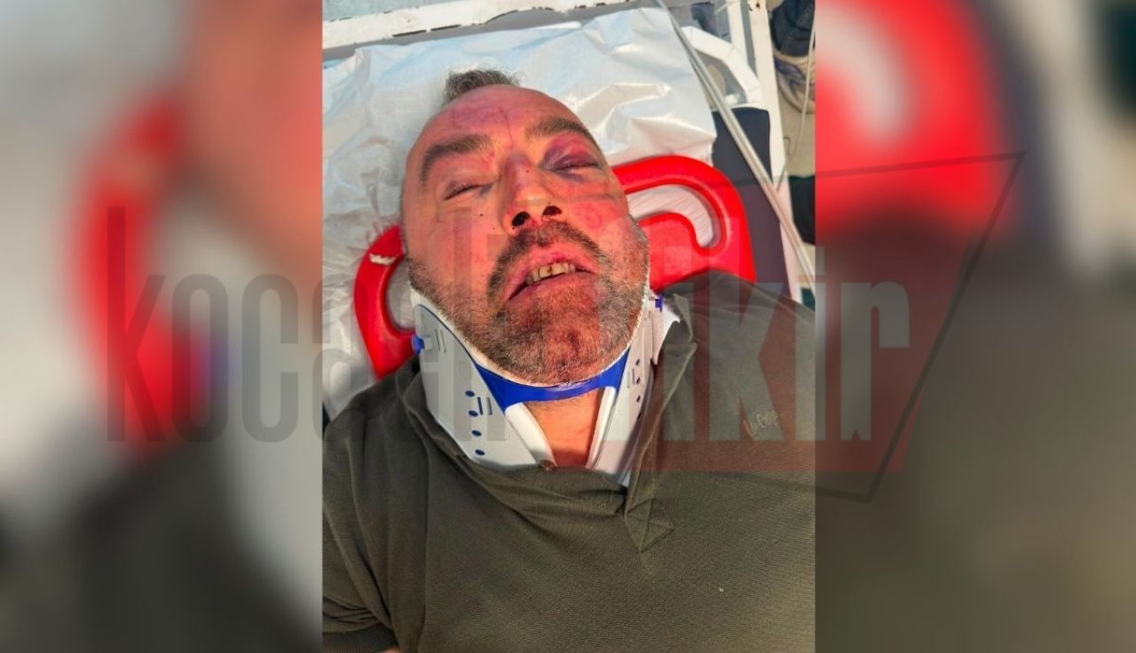 İş insanı Sadi Boz İzmit'te 4 kişi tarafından darp edildi