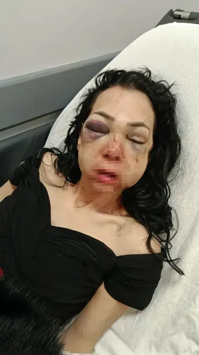 İzmit'te kafe saldırısında ağır yaralanan kadın konuştu 