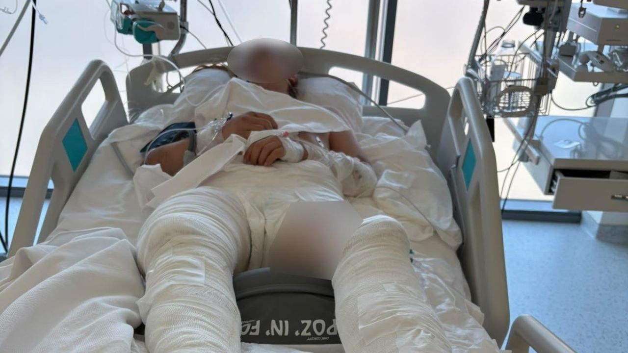 Otomobil genç kıza çarptı, ardından üzerinden geçti