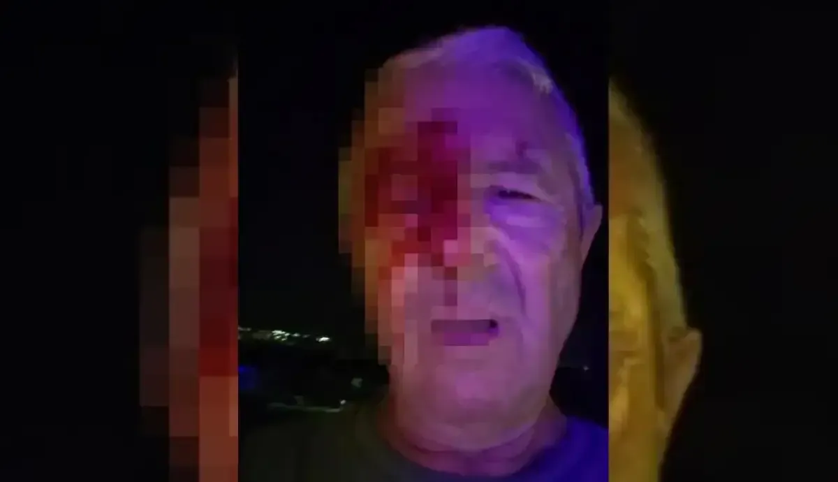 Kocaeli'de muhabire görev başında saldırı: Yumrukların hedefi oldu
