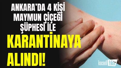 Dünya Sağlık Örgütü, Afrika'da görülen mpox (M Çiçeği) virüsü için