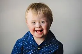 Dünya Down Sendromu Farkındalık Günü: Farklılıkları Kucaklama Zamanı