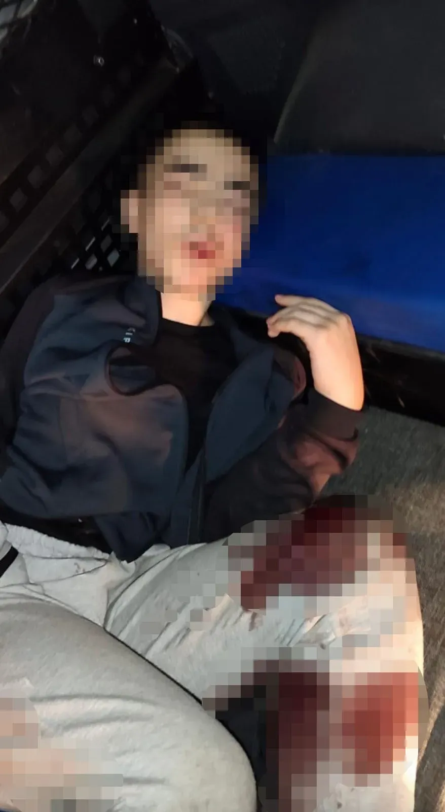 Polis karakoluna saldırı: Yaralı saldırgan yakalandı, görüntüler ortaya çıktı